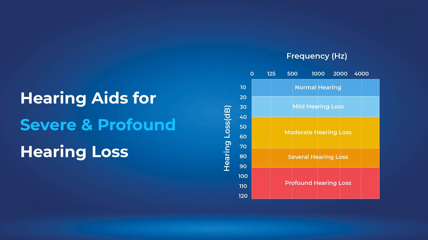Hearing Aids For Severe and Profound Hearing Loss