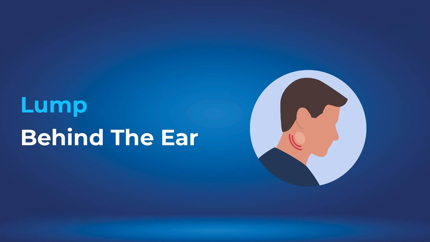 Lump behind the ear