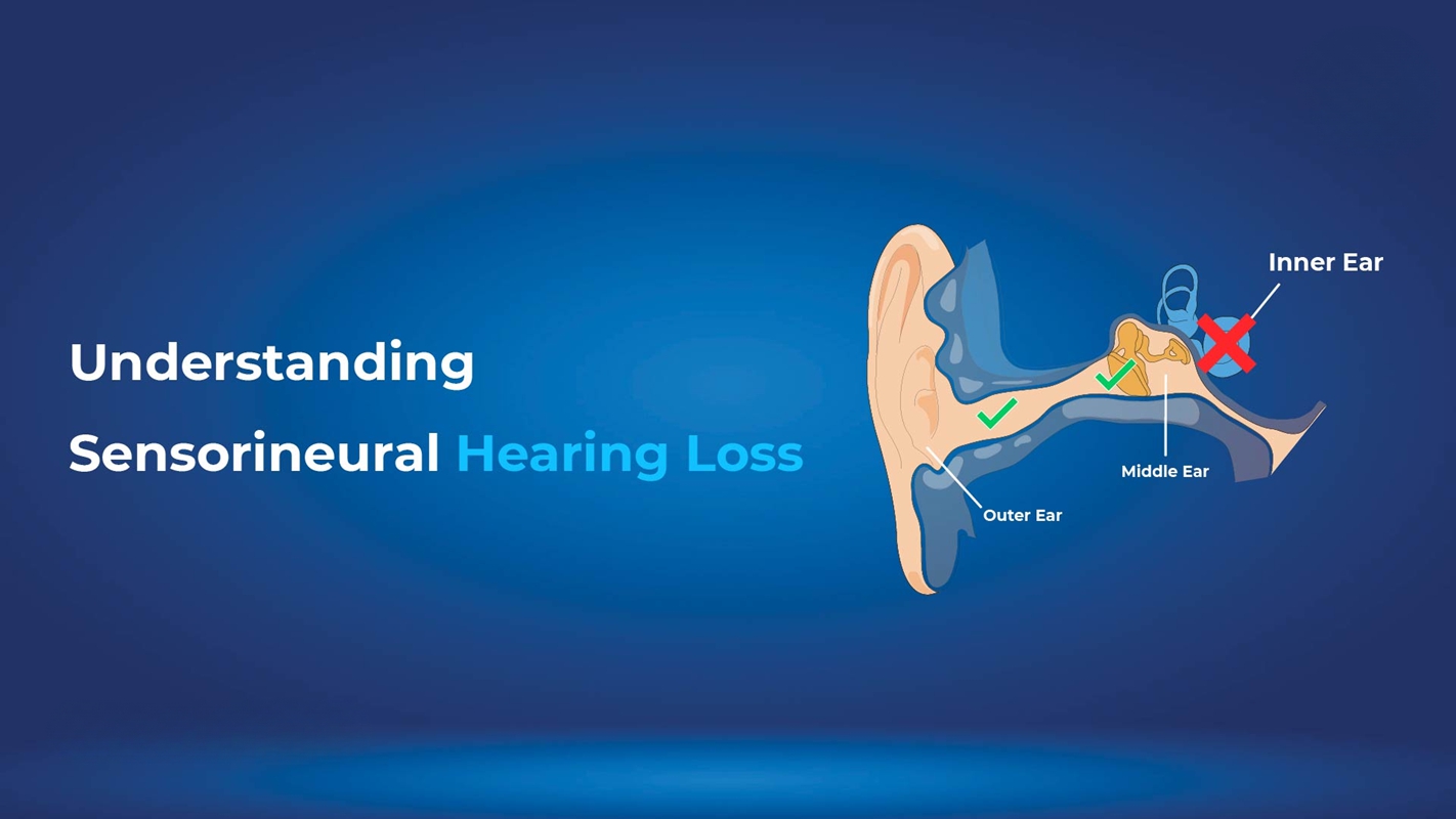  Sensorineural Hearing Loss Symptoms, Causes & Treatment