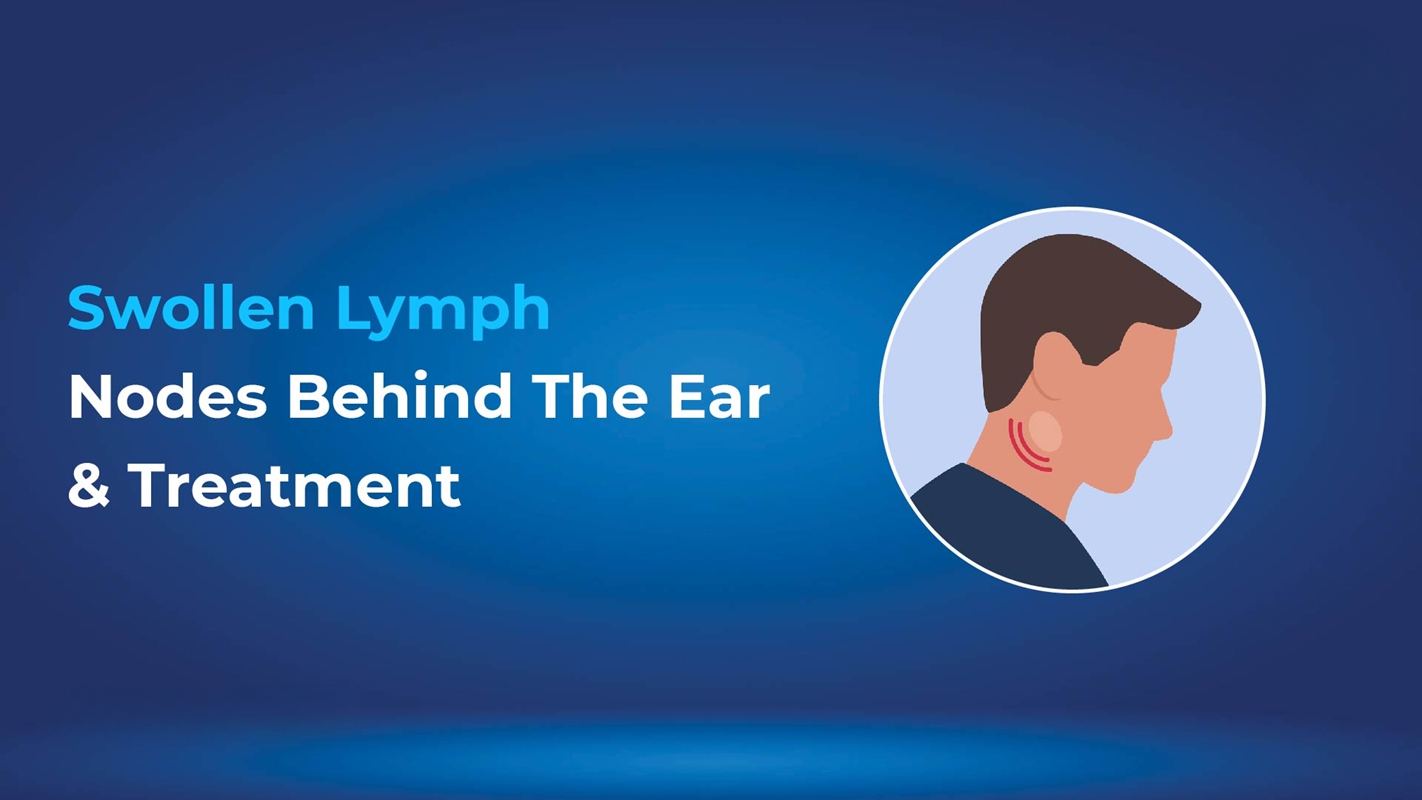 Swollen Lymph Nodes Behind the Ear