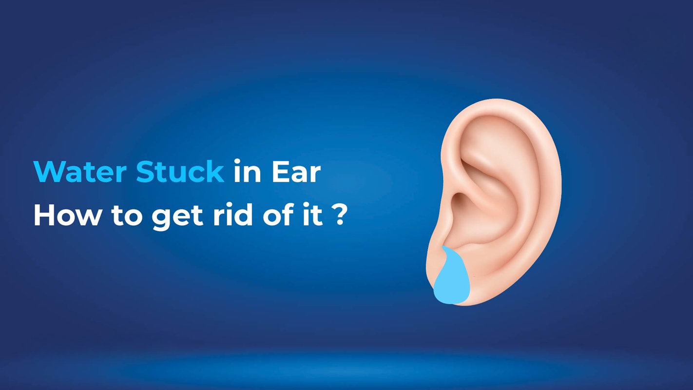 How to Remove Water Stuck in Your Ear