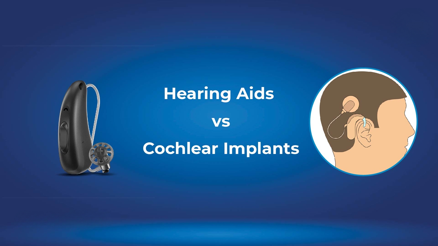 Hearing Aids vs Cochlear Implant
