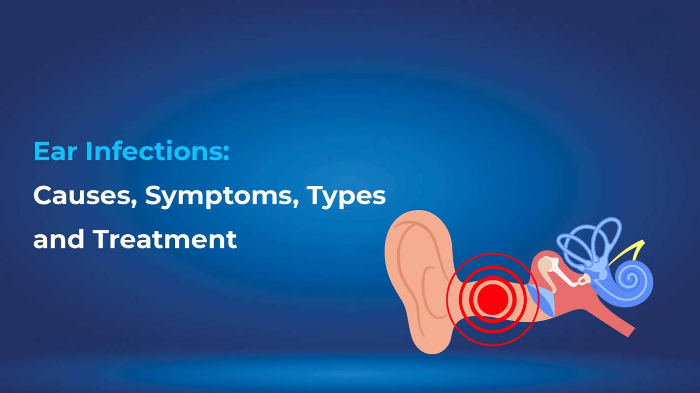 Ear Infections: Causes, Symptoms & Treatment