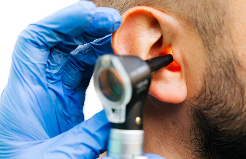 Understanding and Treating Perichondritis of the Ear
