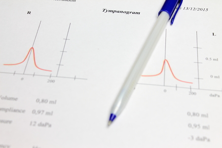 Tympanogram
