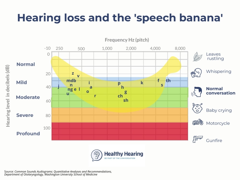 Audiogram with the speech banana overlaid on top.