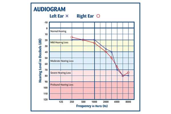 How Often Should You Get a Hearing Test?