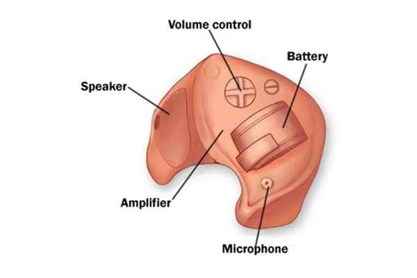 A Guide to the Technology Behind Hearing Devices