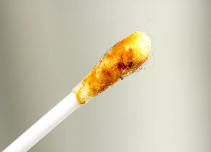 Is Your Earwax Healthy? A Color Guide
