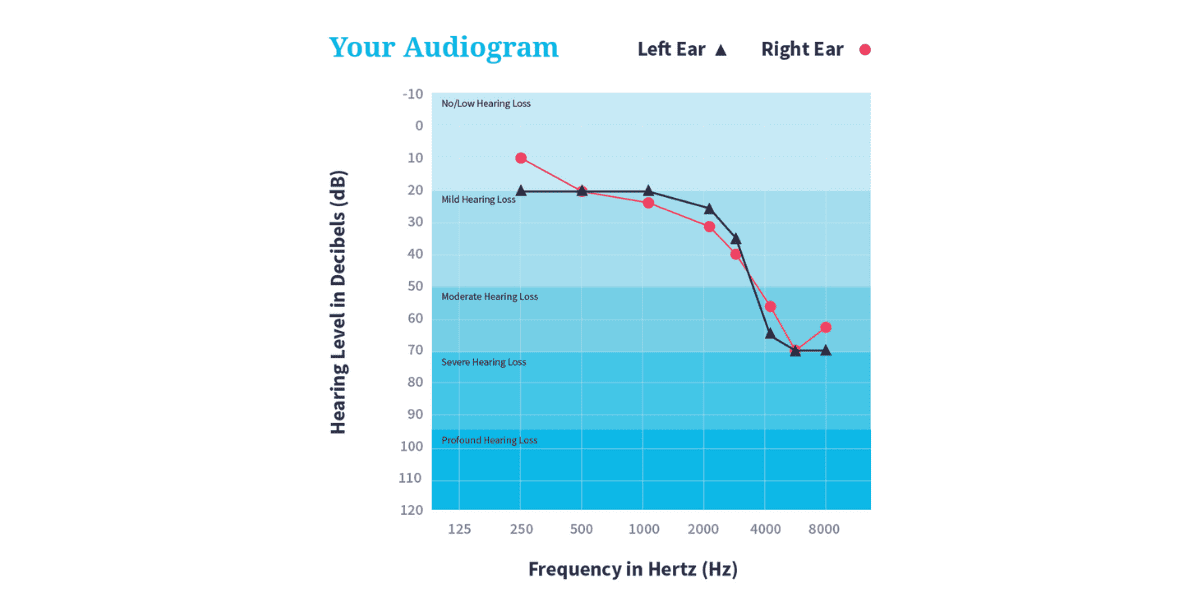 A Beginner's Guide to Your Hearing Test Results