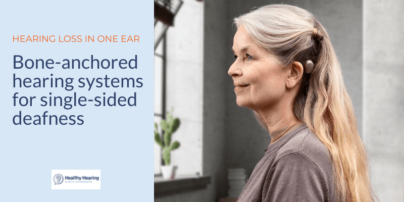 A woman wears a Ponto by Oticon Medical, a type of bone-anchored hearing system.