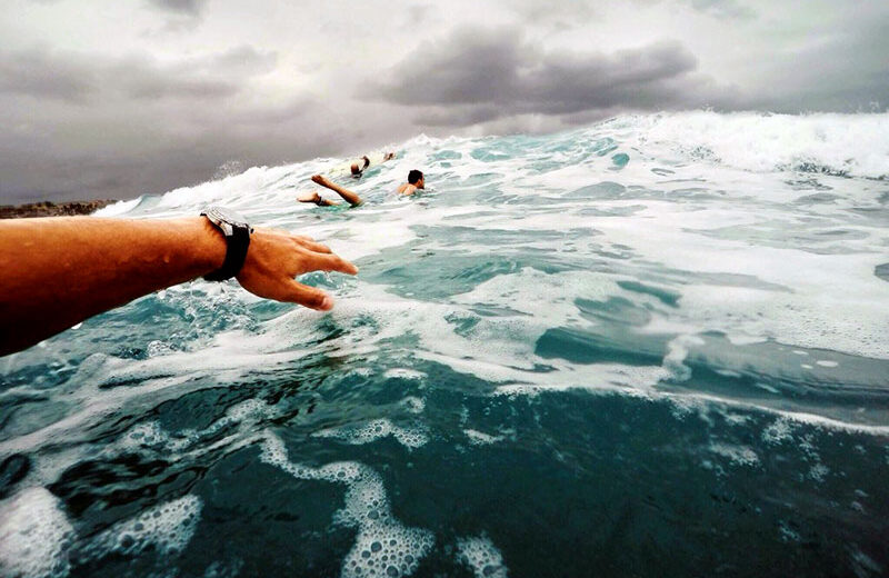 Surfer’s Ear and Swimmer’s Ear