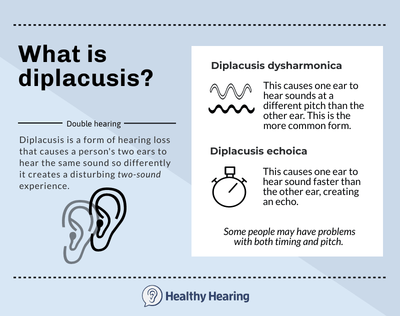 Infographic explaining diplacusis, which is having double hearing, where one ear perceives a different pitch than the other. 